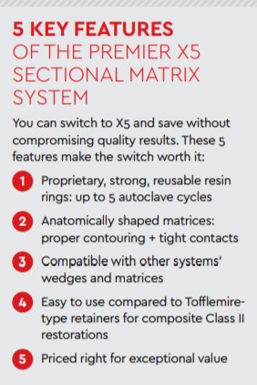 5 key features of the premier x5 sectional matrix system